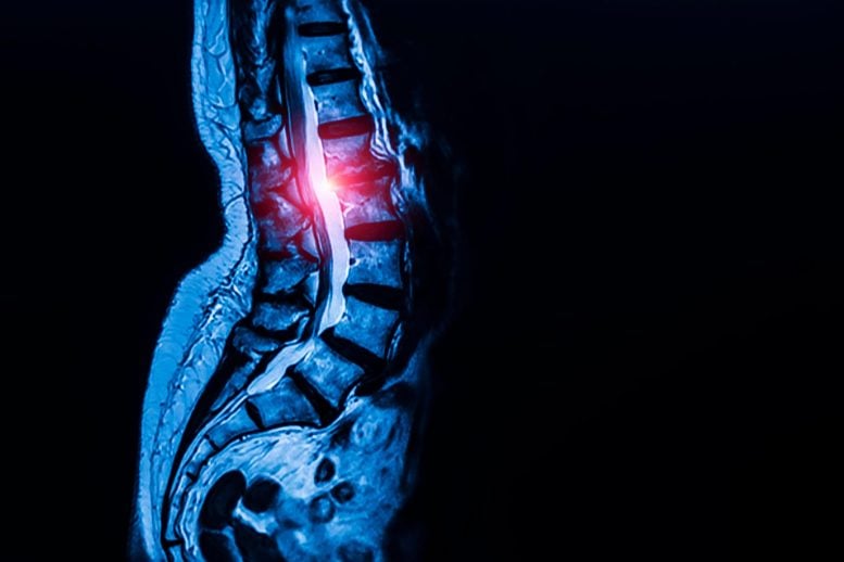 Radiograph X-Ray Back Bone Spinal Pain