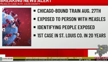 St. Louis County resident diagnosed with measles, 1st case in 20 years