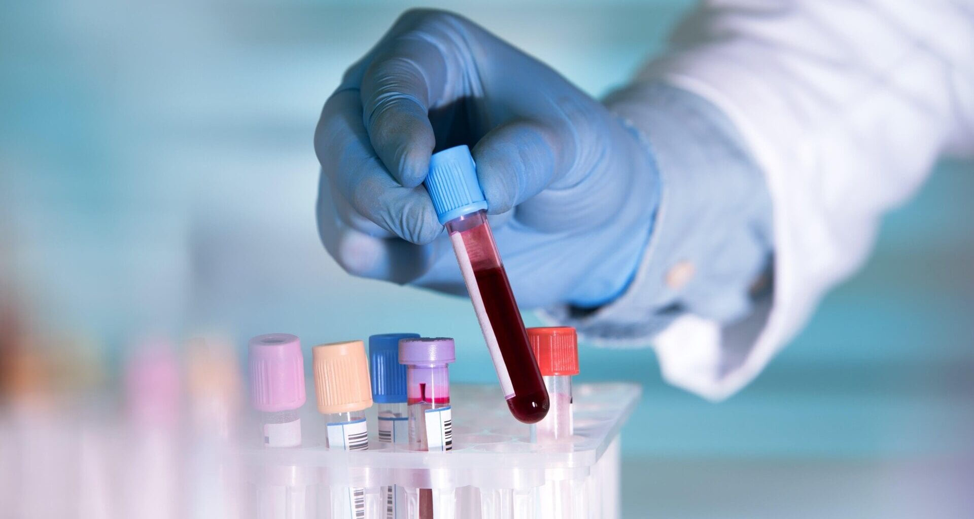 Scientist with vials in a lab