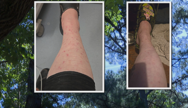 Tick bite, rare bacteria found in dogs at center of Chatham County medical mystery :: WRAL.com