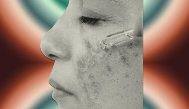 Now Is a Good Time to Start Your Melasma Routine: Products