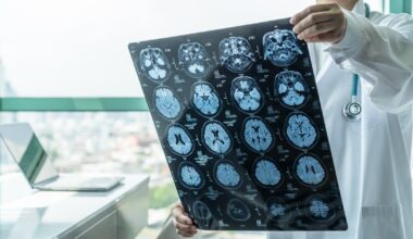 Why patients are waiting anxiously as medical imaging results take weeks to come back