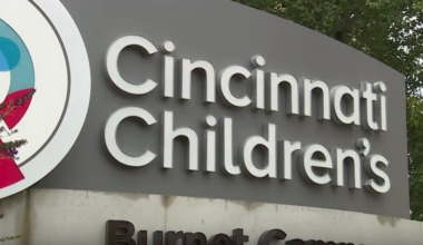 Measles exposure reported at Cincinnati Children's Hospital emergency department