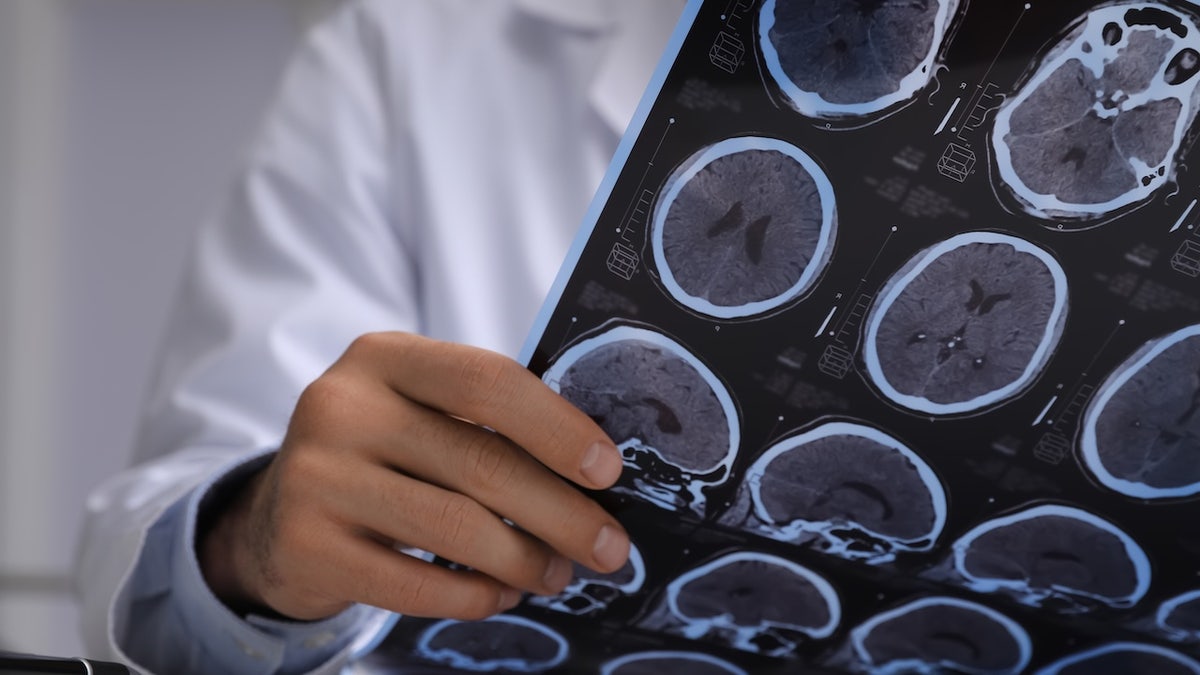 Doctor reading brain scans