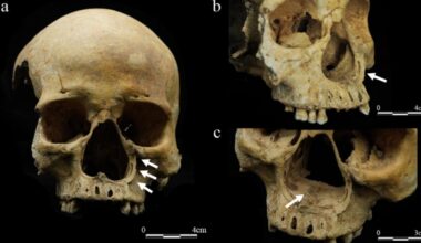 This Skeleton May Prove That Imperial China Really Did Cut Off Noses as Punishment