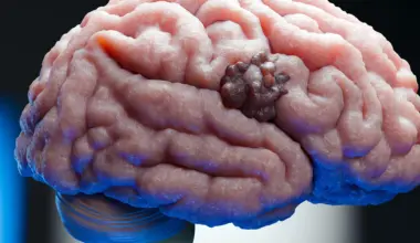 Scientists find a weak spot in one of the deadliest brain cancers - Science Daily
