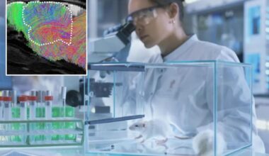Stanford scientists grow human brain tissue inside lab mice
