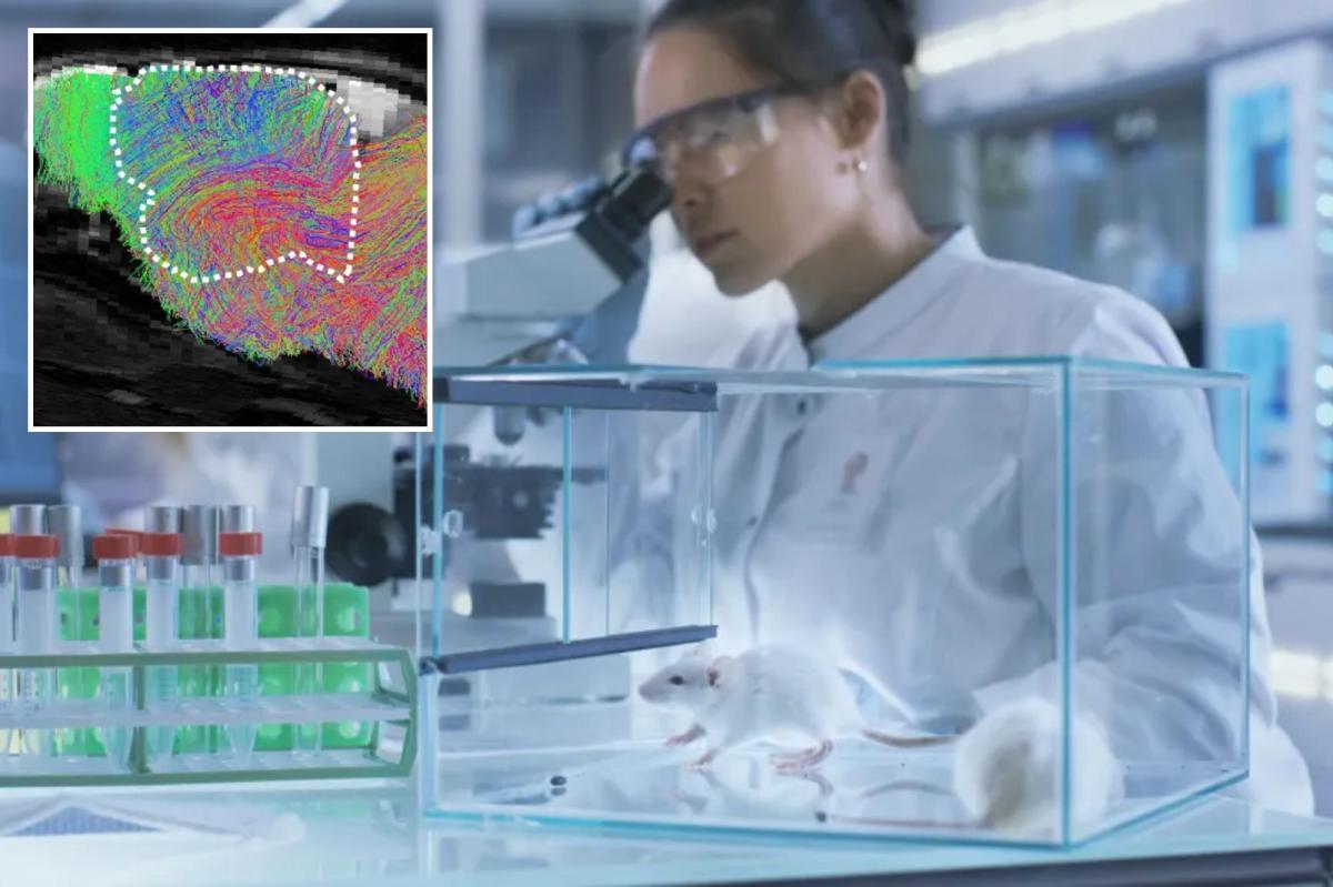 Stanford scientists grow human brain tissue inside lab mice
