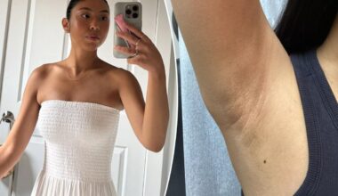 I got a nasty skin condition from shaving — you may be making the same mistake