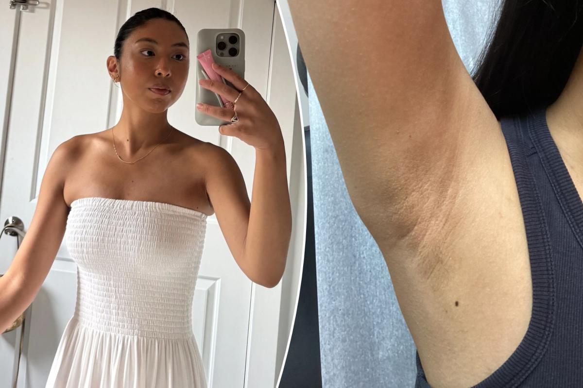 I got a nasty skin condition from shaving — you may be making the same mistake