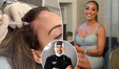 How I restored Melissa Gorga’s thinning hair