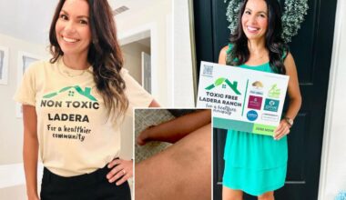Ladera Ranch mom reveals grisly skin condition she developed in town rocked by Ewing sarcoma