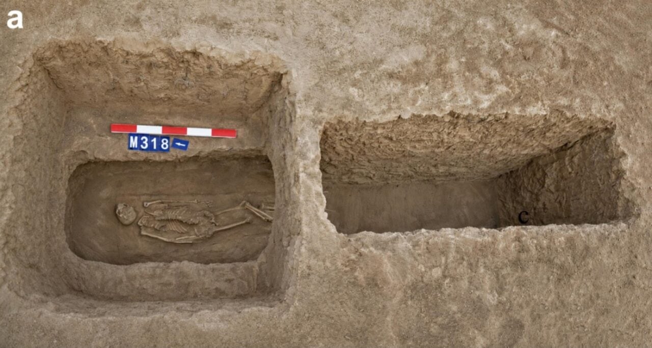 Tomb Nasal Amputation