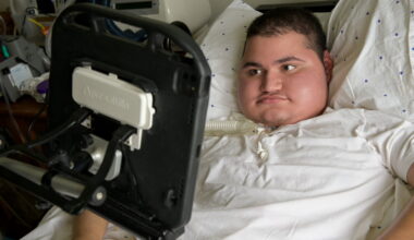 For Syrian refugee with genetic disorder in suburban Chicago, looming Medicaid cutoff has his parents worried