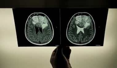 Patients report weeks-long delays for imaging results at Steinberg Diagnostics