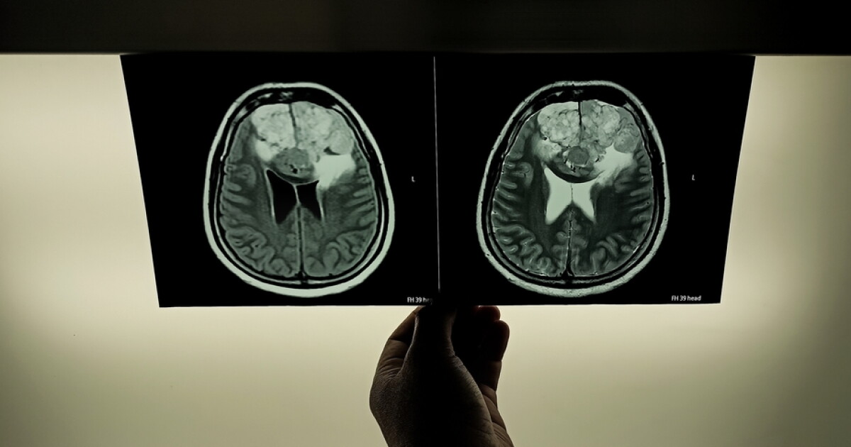 Patients report weeks-long delays for imaging results at Steinberg Diagnostics