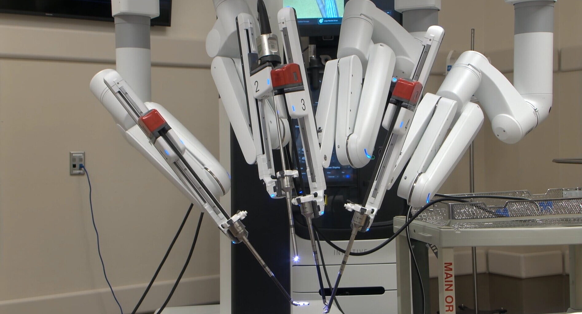 Robotic Whipple surgery changes one patient’s recovery - InForum