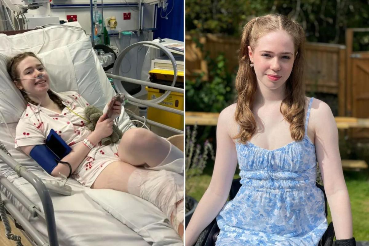 20-year-old with 'suicide disease' begged doctors to amputate her leg