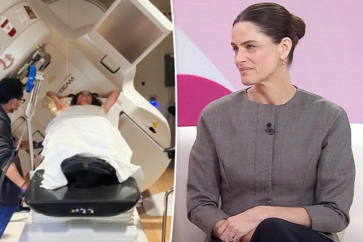 Amanda Peet shares the 'weird' symptom she had before breast cancer diagnosis