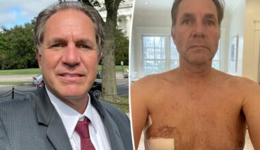 Nipple-twisting prank between friends may have saved man's life