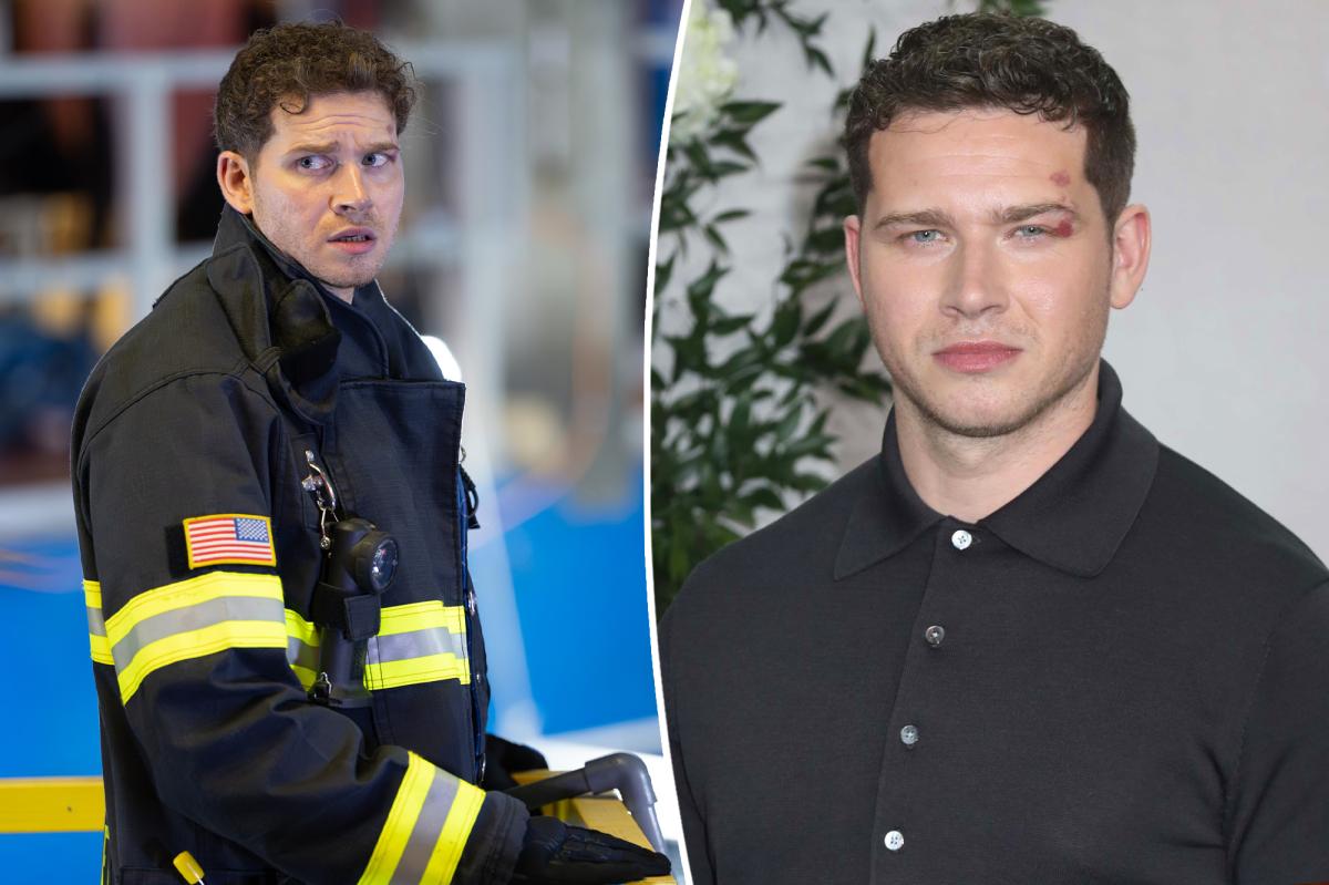 '9-1-1' star Oliver Stark and 3 others injured on set