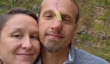 Cherokee County man unrecognizable after breaking up fight between two family dogs