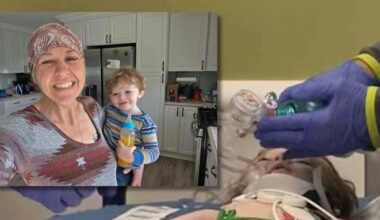 2-year-old suffers catastrophic brain injury after exposure to 7-OH