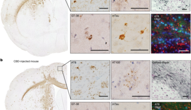 Prion-like transmission of human tau strains in the mouse brain