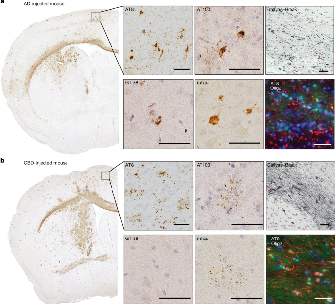 Prion-like transmission of human tau strains in the mouse brain
