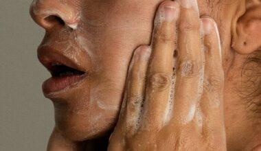 Adult acne is real, but there are ways to treat it. Here's what to know