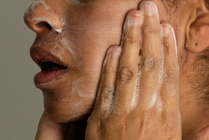 Adult acne is real, but there are ways to treat it. Here's what to know