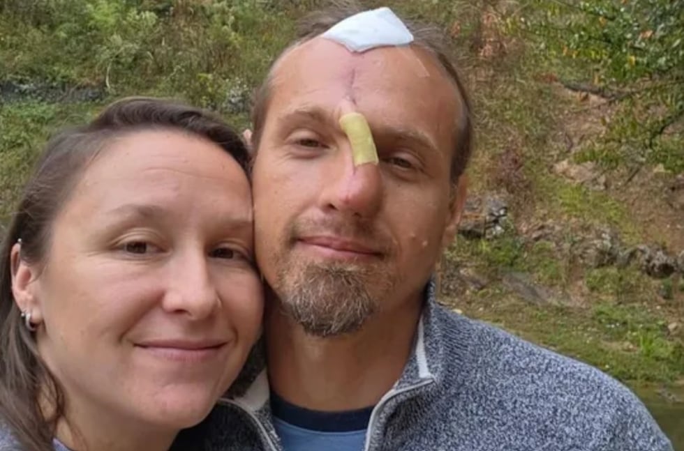 Life changed in a split second when Dustin Low tried to break up a fight between two family pets.