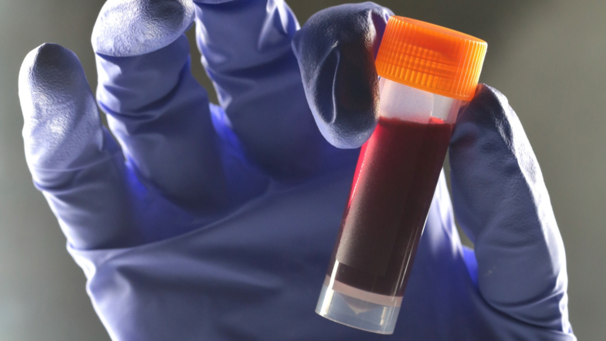 One Blood Type Seems to Carry a Higher Risk of Type 2 Diabetes : ScienceAlert