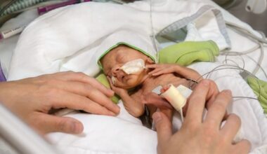 Getinge Targets Neonatal Care with Smaller Edi Catheter
