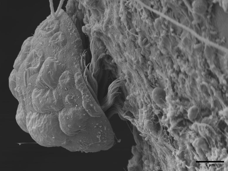 Protist Parasite Living on Tanystylum Kiixin
