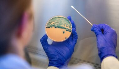 Shigella antibiotic resistance rising as drug-resistant strains grow