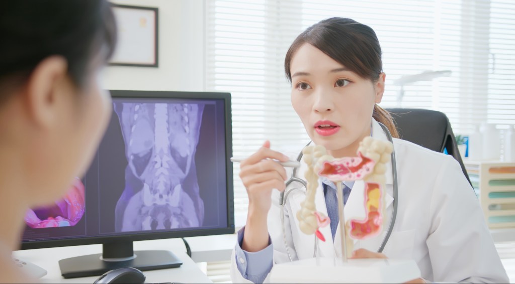 A female doctor explains a colorectal cancer diagnosis to a patient, using an anatomical model of the colon and a medical scan displayed on a computer monitor in the background.