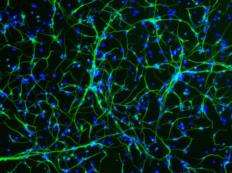 Fluorescence light micrograph of a network of green and blue neurons.