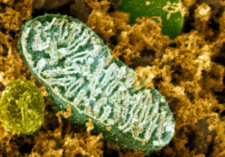 Coloured scanning electron micrograph of a mitochondrion in a nerve cell, showing the wiggly cristrae inside.