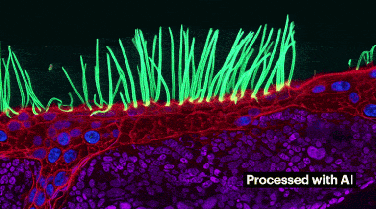 AI processed diffractive super-resolution microscopy sequence showing brightly coloured beating airway cilia from a child with primary ciliary dyskinesia.