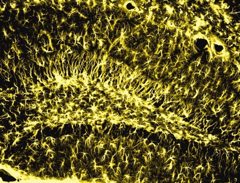Confocal microscopy immunofluorescence micrograph of bright yellow branching networks of thread-like structures against a black background