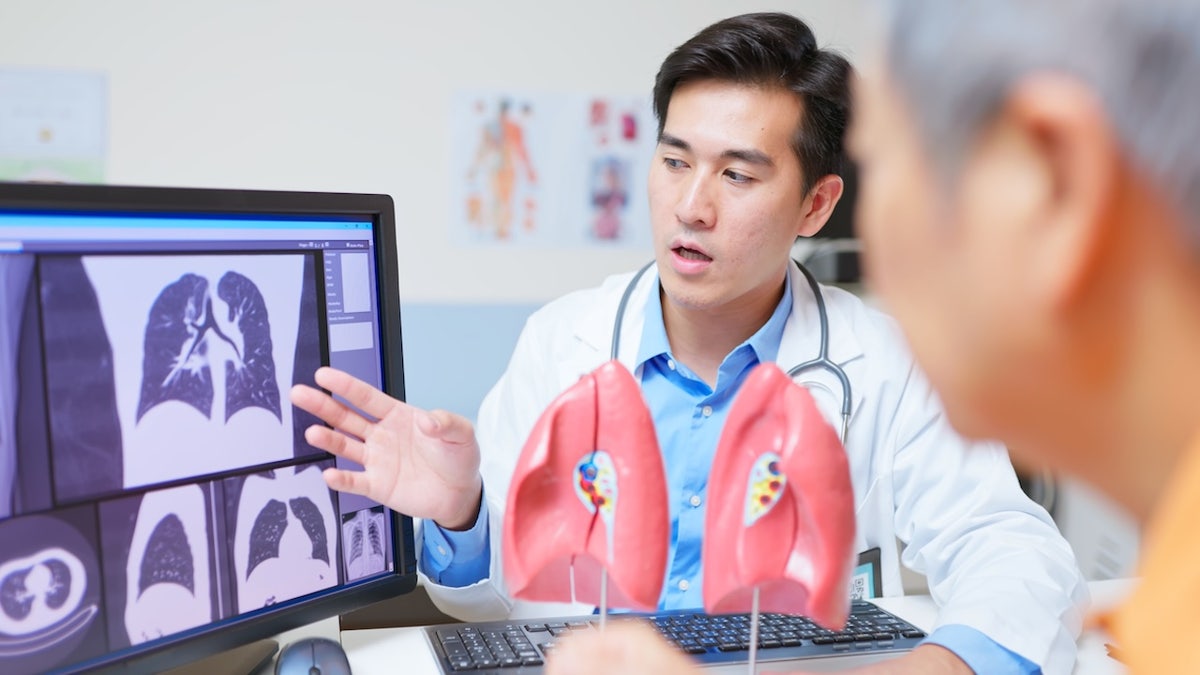 doc points to lung cancer screening