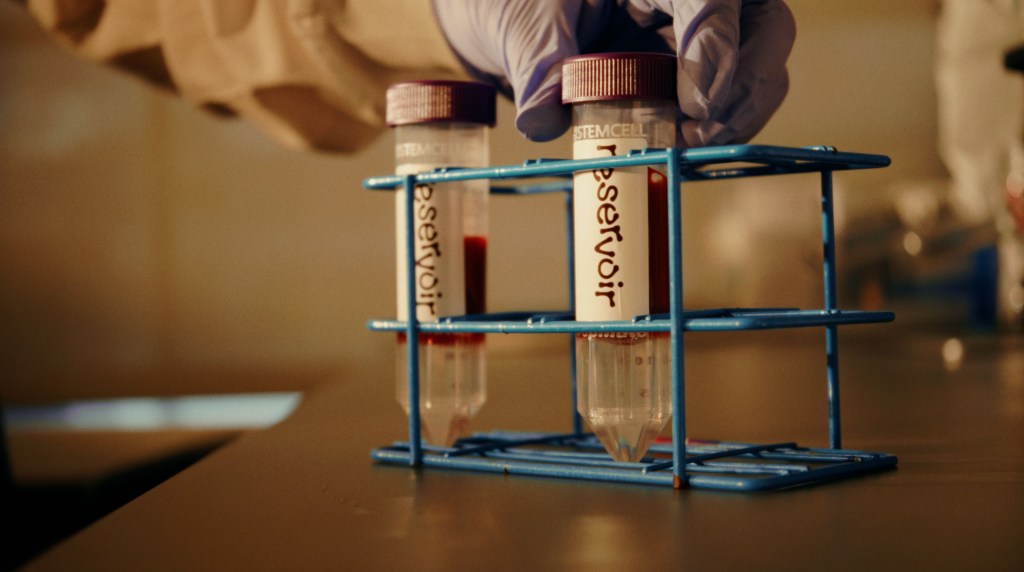 Gloved hands place a test tube labeled reservoir containing blood into a blue rack.