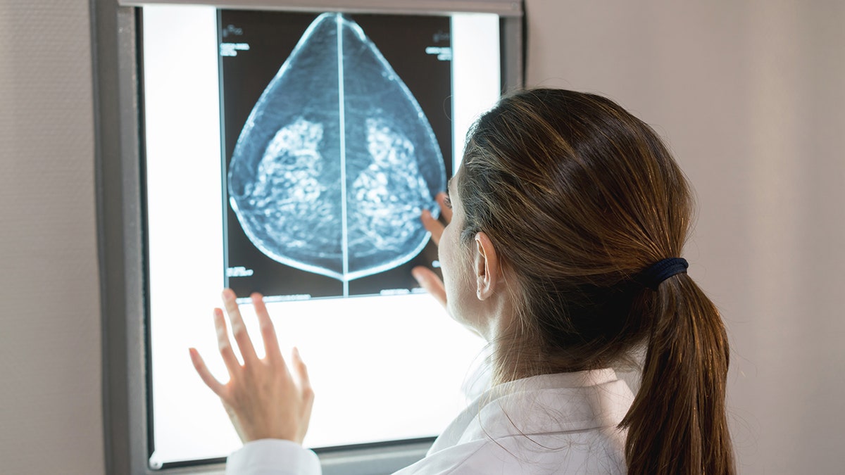 doctor reviewing mammogram screening