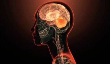 The brain may have arisen from 2 separate nervous systems that got squished together, study suggests