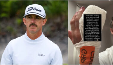 Veteran Tour Pro Suffers 'Partial Amputation' After Gruesome Hand Injury