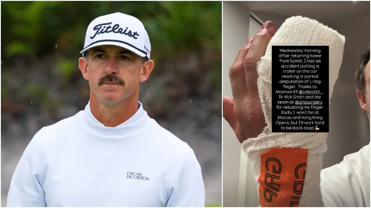 Veteran Tour Pro Suffers 'Partial Amputation' After Gruesome Hand Injury