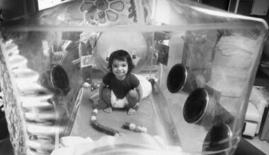 How the Boy in the Bubble Died at Age 12 from a Procedure That Was Supposed to Save His Life