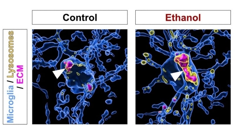 Alcohol Triggers Immune Cells to Destroy The Brain's Structural Matrix, Study in Mice Shows