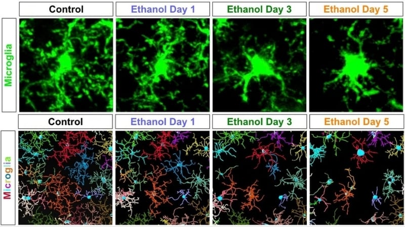 Alcohol Triggers Immune Cells to Destroy The Brain's Structural Matrix, Study in Mice Shows